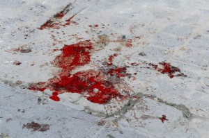 Syria: Zbrodnie szczurów w Adra